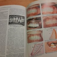 Заболявания на пародонта- Тереза Джемилева -1999 г., снимка 5 - Специализирана литература - 42554676