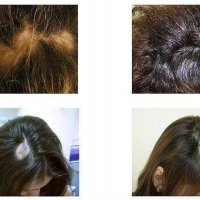 Тоник активатор за растеж на косата, снимка 3 - Продукти за коса - 34151171