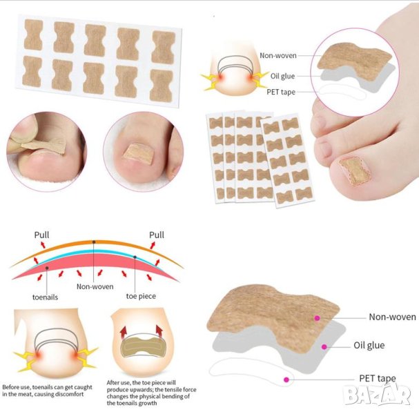 Комплект от 10 Броя Коригиращи Лепенки за Нокти Врастнал Нокът Врастнали Нокти Корекция на Ноктите, снимка 1
