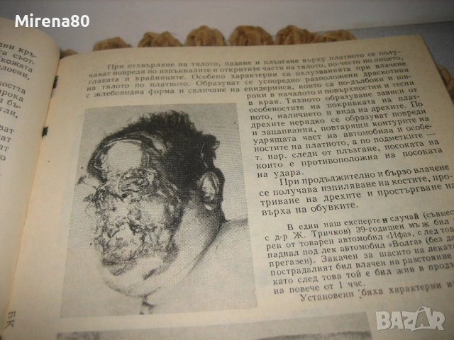 Съдебна медицина - 1980 г., снимка 6 - Специализирана литература - 52326421