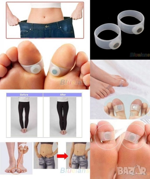 Магнитни пръстени за отслабване, снимка 1