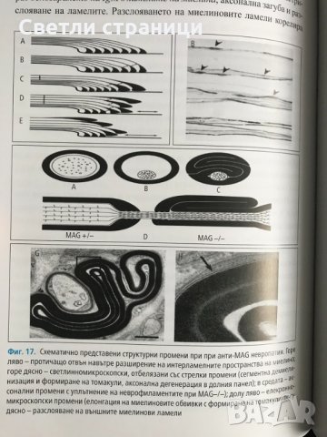 Имуномедиирани възпалителни невропатии - Пламен Цветанов, снимка 7 - Специализирана литература - 35771643