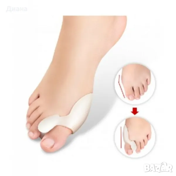 Коригиращ силиконов разделител за крака, снимка 1