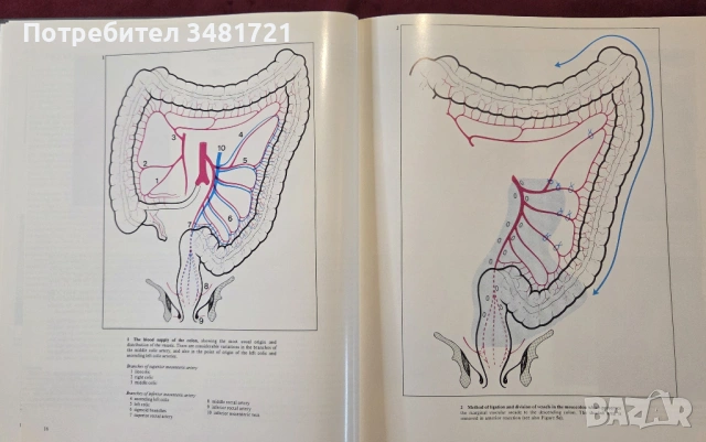 Голям атлас на колоректалната хирургия / A Colour Atlas of Colorectal Surgery, снимка 6 - Специализирана литература - 53748180