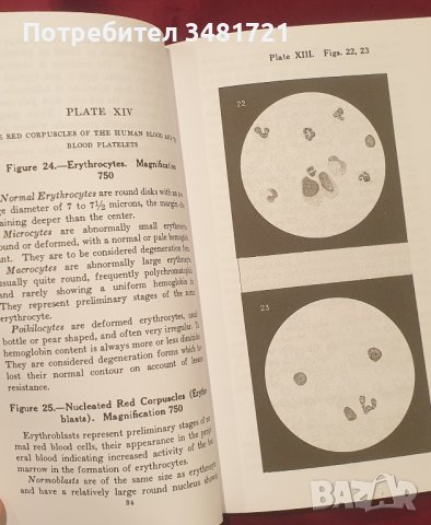 Хематологичен атлас / Hematological Atlas, снимка 6 - Енциклопедии, справочници - 41376805