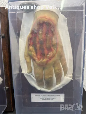 УНИКАЛНО Восъчни Ръчно Изработени Анатомични Мулажи КОЛЕКЦИЯ №69340 , снимка 6 - Антикварни и старинни предмети - 50402170