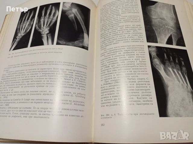 Медицина -Рентгенова Диференциална диагноза-том 1, снимка 6 - Специализирана литература - 49148735