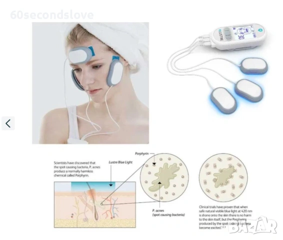 Сбогом АКНЕ!  Уред срещу акне LUSTER Pure Light Pro, снимка 3 - Други - 53486816