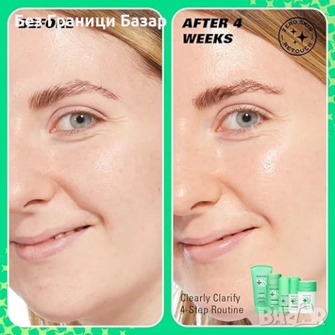 Нов Revolution Веган серум против несъвършенства – ниацинамид + салицил 30мл, снимка 3 - Козметика за лице - 51186356