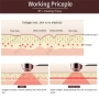 Портативен RF термаж радиочестотен лифтинг, Бръчки, увиснала кожа, снимка 8