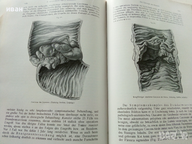 Die Chirurgie - Band V- Kirschner, M. und O. Nordmann - 1927 г., снимка 8 - Антикварни и старинни предмети - 36460717