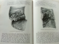 Die Chirurgie - Band V- Kirschner, M. und O. Nordmann - 1927 г., снимка 8