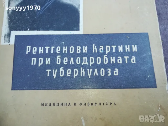 ТУБЕРКОЛОЗА 2210241119, снимка 2 - Специализирана литература - 47673891