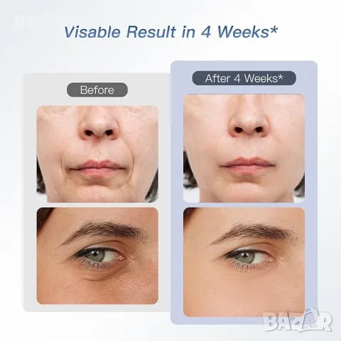 IBORRIA Уред за лифтинг и за грижа за кожата на лицето 6-в-1 , снимка 3 - Масажори - 50324434