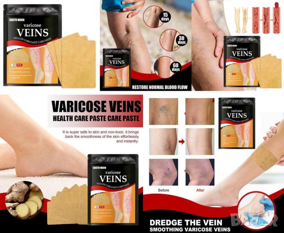 Детокс Лепенки за Разширени Вени Варикозни Капиляри Варикоза Флебит Атеросклероза Тежки Подути Крака
