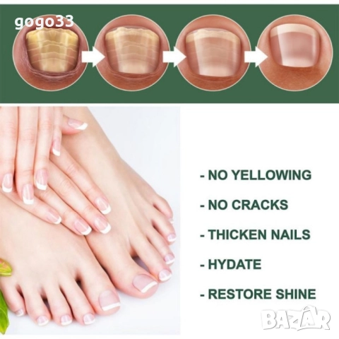 лак против гъбички , снимка 9 - Други - 51861216