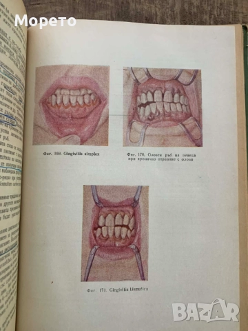 Терапевтична стоматология-Димитър Свраков, снимка 8 - Специализирана литература - 52863831
