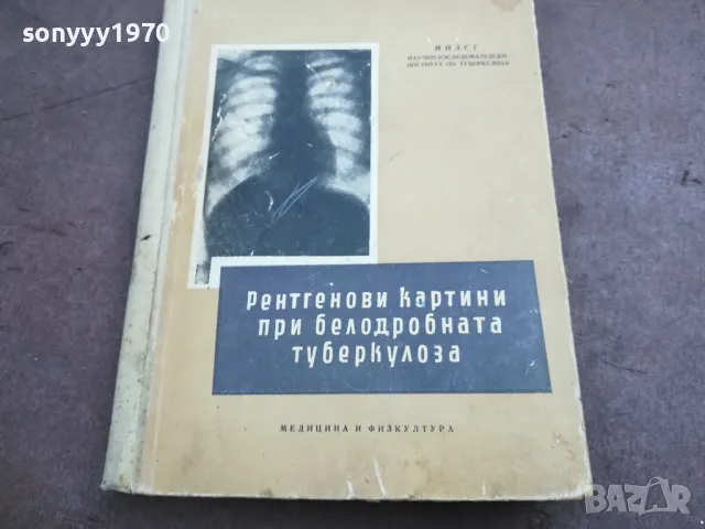 ТУБЕРКОЛОЗА 2210241119