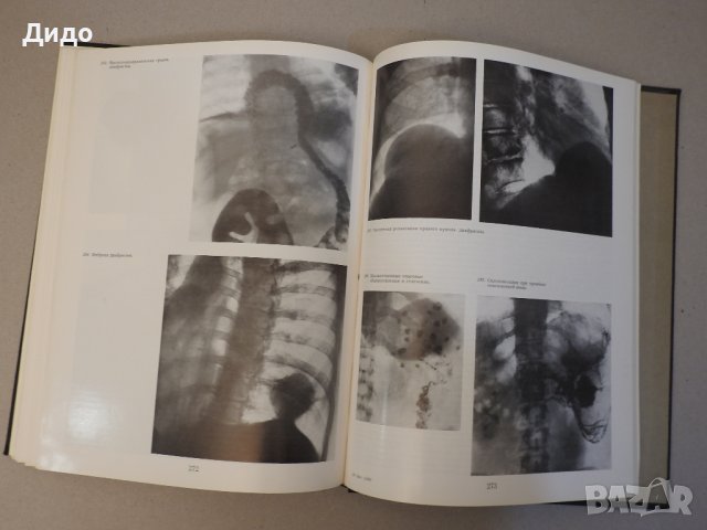 Рентгенодиагнистический атлас. Том 2: Болезни внутренних органов, снимка 10 - Специализирана литература - 39227598
