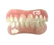 Instant Smile Lowers усмивка за минути /комплект от горни и долни зъби, снимка 1
