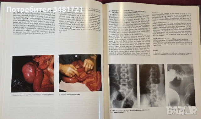 Голям атлас на колоректалната хирургия / A Colour Atlas of Colorectal Surgery, снимка 12 - Специализирана литература - 53748180