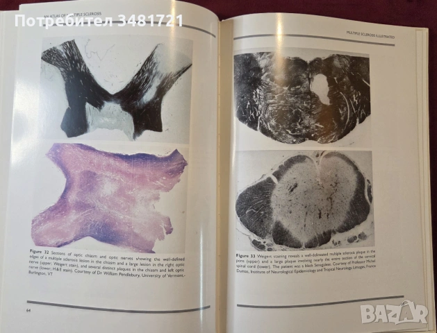 Голям атлас на множествената склероза / An Atlas of Multiple Sclerosis, снимка 9 - Специализирана литература - 53748194