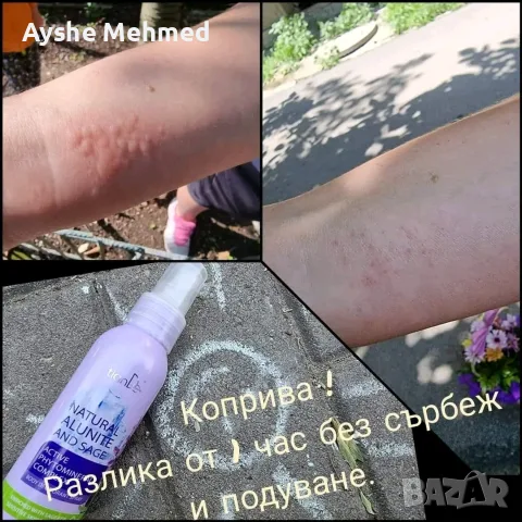 след епилация; за бързо заздравяване на рани и с цел антибактериалност; успокоява раздразненията и