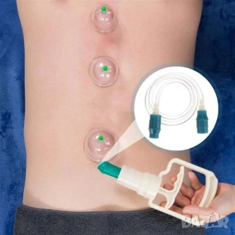 Комплект Автоматични Вендузи 6 бр. за козметичен и медицински масаж, снимка 3 - Други - 51887643