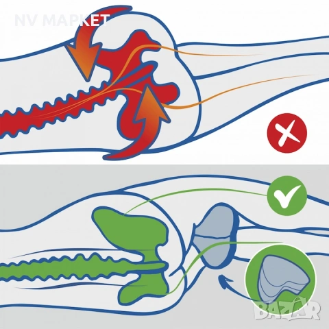 Ергономична възглавница за крака с мемори пяна – Комфорт и подкрепа всяка нощ, снимка 3 - Възглавници - 53192194