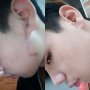 Крем за белези Scar Removal , снимка 5