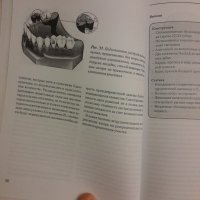Конструкция на частичната снемаема зъбна протеза- Хоман, Хилшер- 2002г., 194стр., снимка 10 - Специализирана литература - 42555345