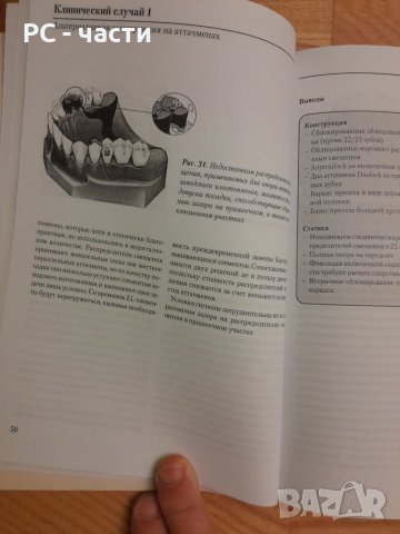 Конструкция на частичната снемаема зъбна протеза- Хоман, Хилшер- 2002г., 194стр., снимка 10 - Специализирана литература - 42555345