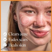 47 Skin Daily Maintenance Комплект за грижа за кожата на лицето за заличаване на петна и белези , снимка 5 - Комплекти и лотове - 44494270
