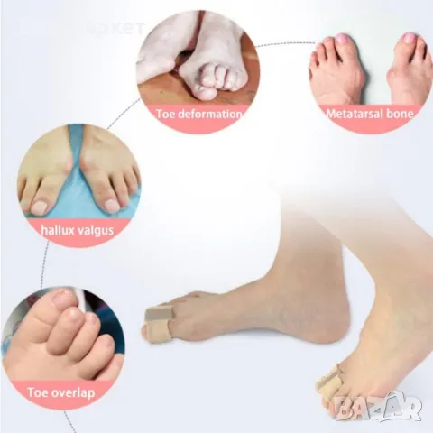 Силиконов разделител за пръстите на краката, коректор за корекция на палеца, снимка 2 - Други - 48903383