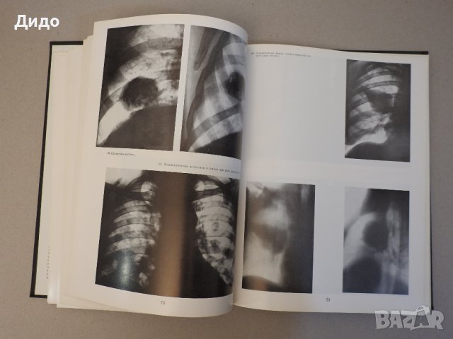 Рентгенодиагнистический атлас. Том 2: Болезни внутренних органов, снимка 6 - Специализирана литература - 39227598