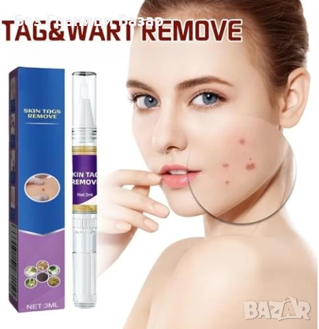 Нов гел Крем за бързо премахване на брадавици – лице, ръце и крака, снимка 1