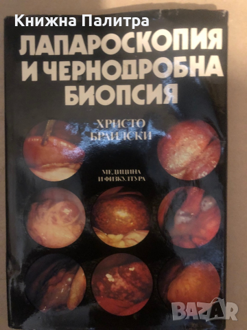 Лапароскопия и чернодробна биопсия Христо Браилски, снимка 1 - Специализирана литература - 36285758