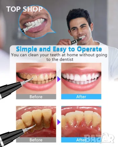 Ултразвуков уред за почистване на зъби - плака и зъбен камък, снимка 3 - Друго оборудване - 48673159