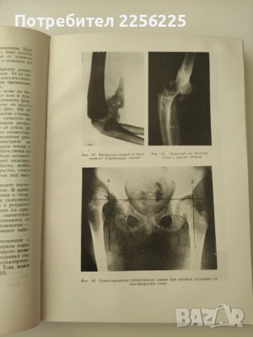Учебник по рентгенология , снимка 3 - Специализирана литература - 40957544