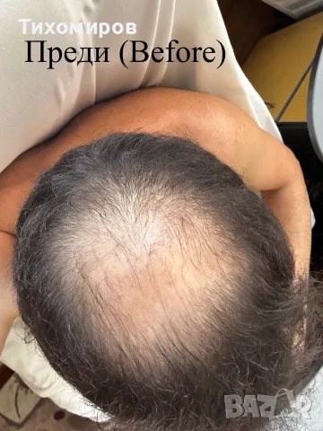 Фибри за коса (Всички цветове) - Изпитан продукт от мен - 27.5g. Hair Building Fibers (All Colors), снимка 2 - Продукти за коса - 55955001
