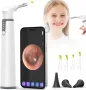 Професионален смарт отоскоп ScopeAround Otoscope Ear Camera, WiFi, снимка 1