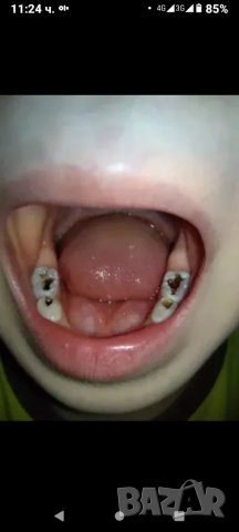 Избелваща паста за зъби за емайл и блясък , снимка 8 - Други - 41901926