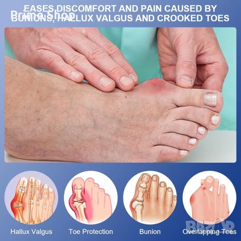 Шина за корекция на изпъкнало кокалче Hallux Valgus и разделител за пръсти, снимка 2 - Други - 53736700