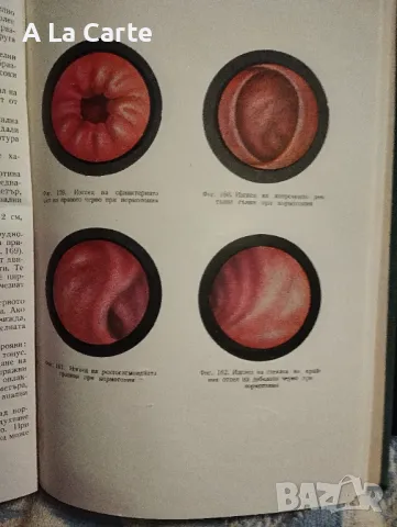 Ректороманоскопия, снимка 3 - Специализирана литература - 48346303