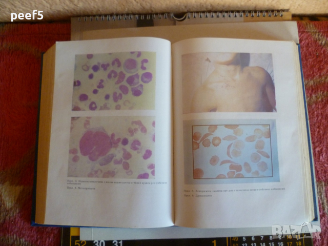 "Детски болести" Учебник за студенти медици, снимка 4 - Специализирана литература - 36356974