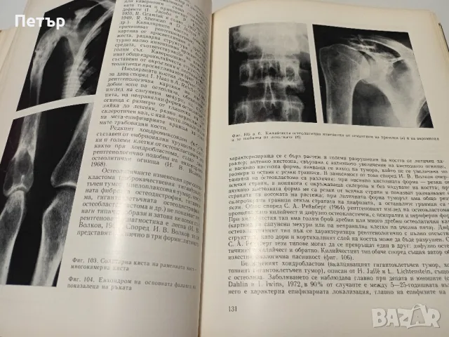 Медицина -Рентгенова Диференциална диагноза-том 1, снимка 5 - Специализирана литература - 49148735