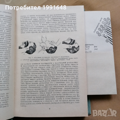 Реаниматология (на руски език) – под редакцията на д-р.мед.наук Г.Н.ЦьIбуляка, снимка 12 - Други - 36236305