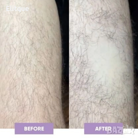 Компактен кристален уред за премахване на излишното окосмяване , снимка 11 - Други - 52796081