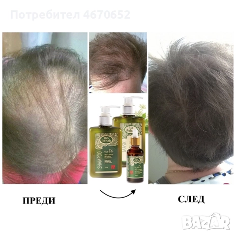 Комплект за растеж на косата „Bio Rehab“, снимка 3 - Продукти за коса - 52755138