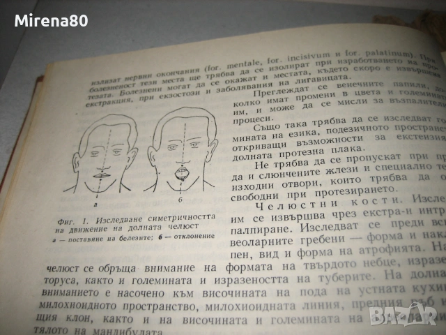Клиника на ортопедичната стоматология - 1984 г., снимка 4 - Специализирана литература - 53529249